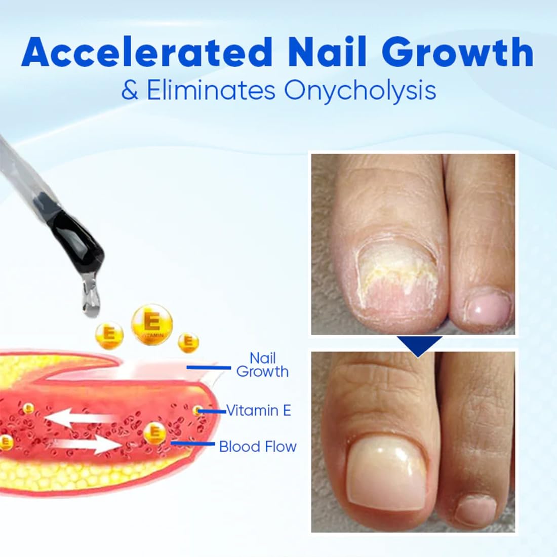 OnyxoGuard Nail Growth & Repair Serum - Strengthens Thin, Brittle & Damaged Nails - Crystal Clear Nail Strengthener Base Coat Treatment (1PC) - Perfect for Weak Nails, Manicures & At-Home Nail Care