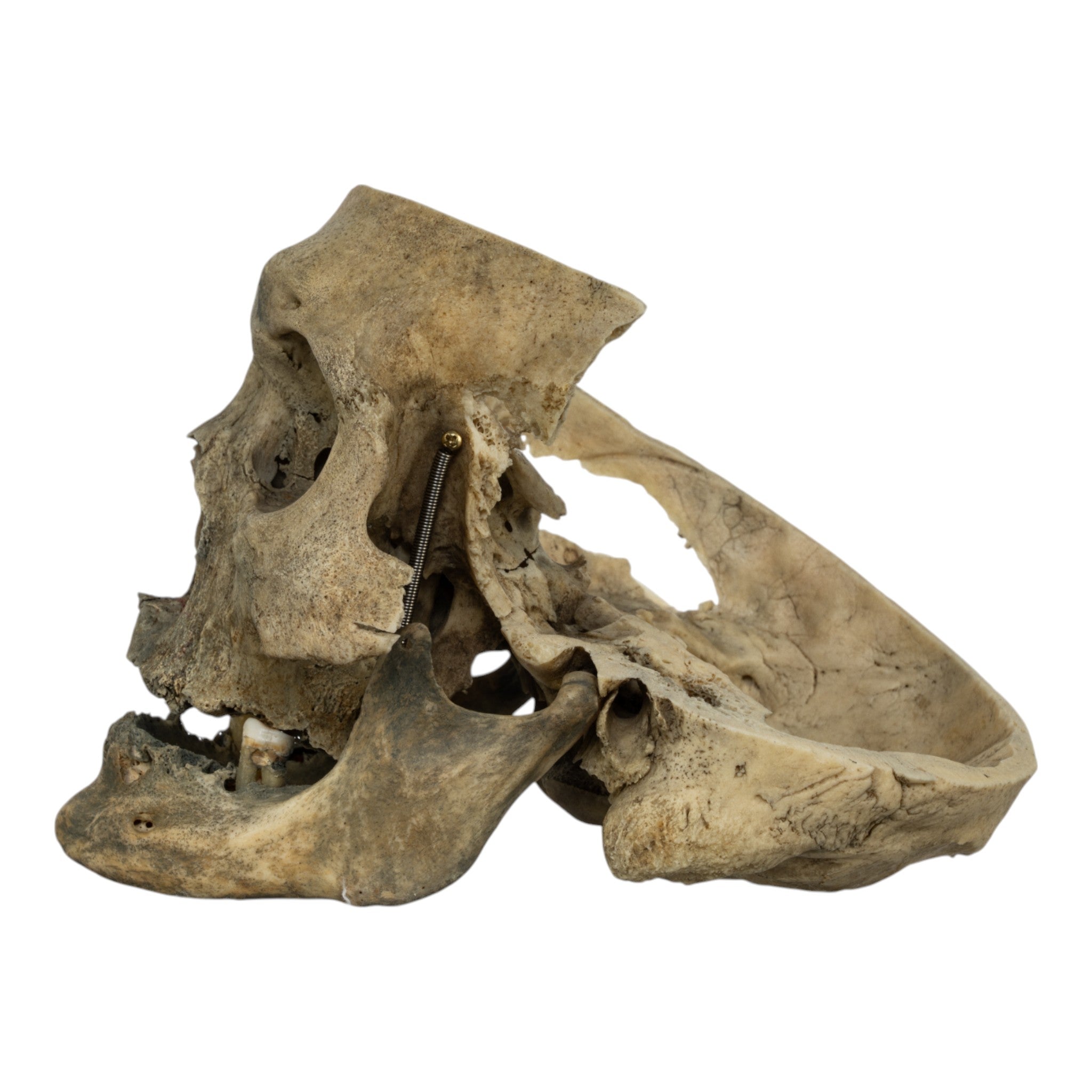 Authentic Real Human Skull for Medical Study & Halloween Decor - Perfect for Anatomy Education, Horror Props, and Gothic Home Decor