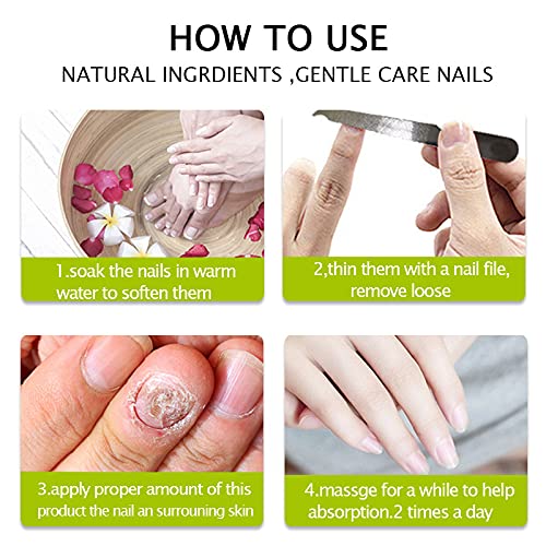 Efero Nail Treatment Repair Gel - Fungal Toenail Treatment, Nail Repair Cream for Yellow, Cracked & Split Nails - Renews Damaged Nails (4PCS) - Perfect for Home Pedicures & Nail Care Routines