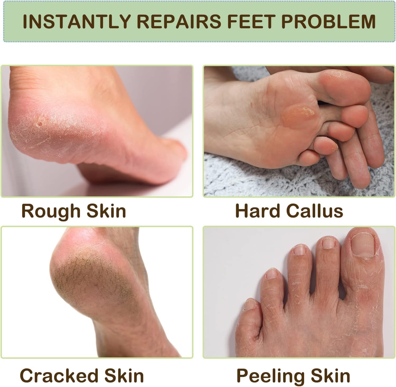 Moisturizing Silicone Gel Socks for Dry Cracked Feet - Heel Repair & Foot Care with Natural Oil & Vitamin E - Spa Treatment Socks for Women & Men (1 Pair, Multicolor) - Perfect for Overnight Foot Therapy & Pedicure Care