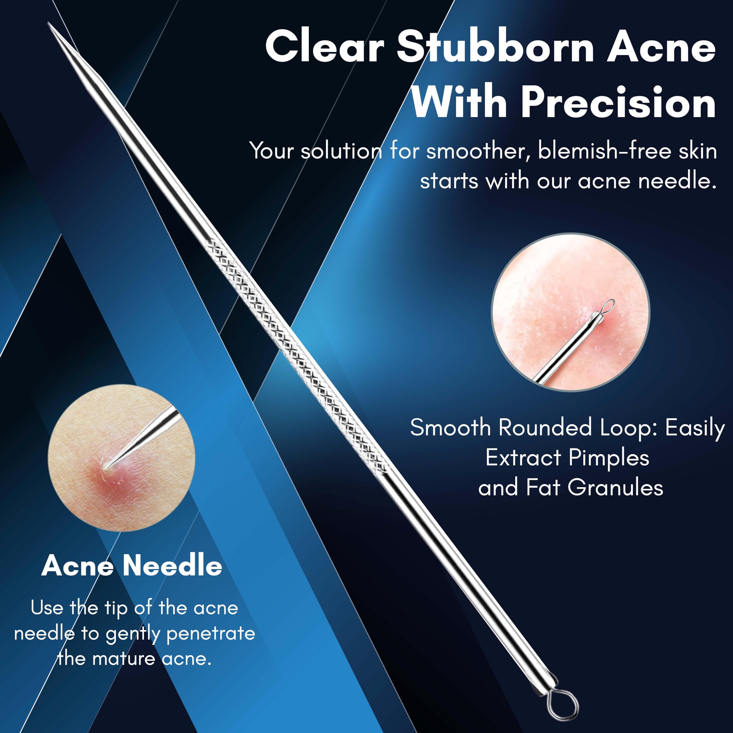 Beauté Secrets Blackhead & Acne Removal Kit - 4 Piece Stainless Steel Comedone Extractor Tools for Face & Nose - Pimple Popper Set for Women & Men - Perfect for Home Skincare & Blemish Treatment
