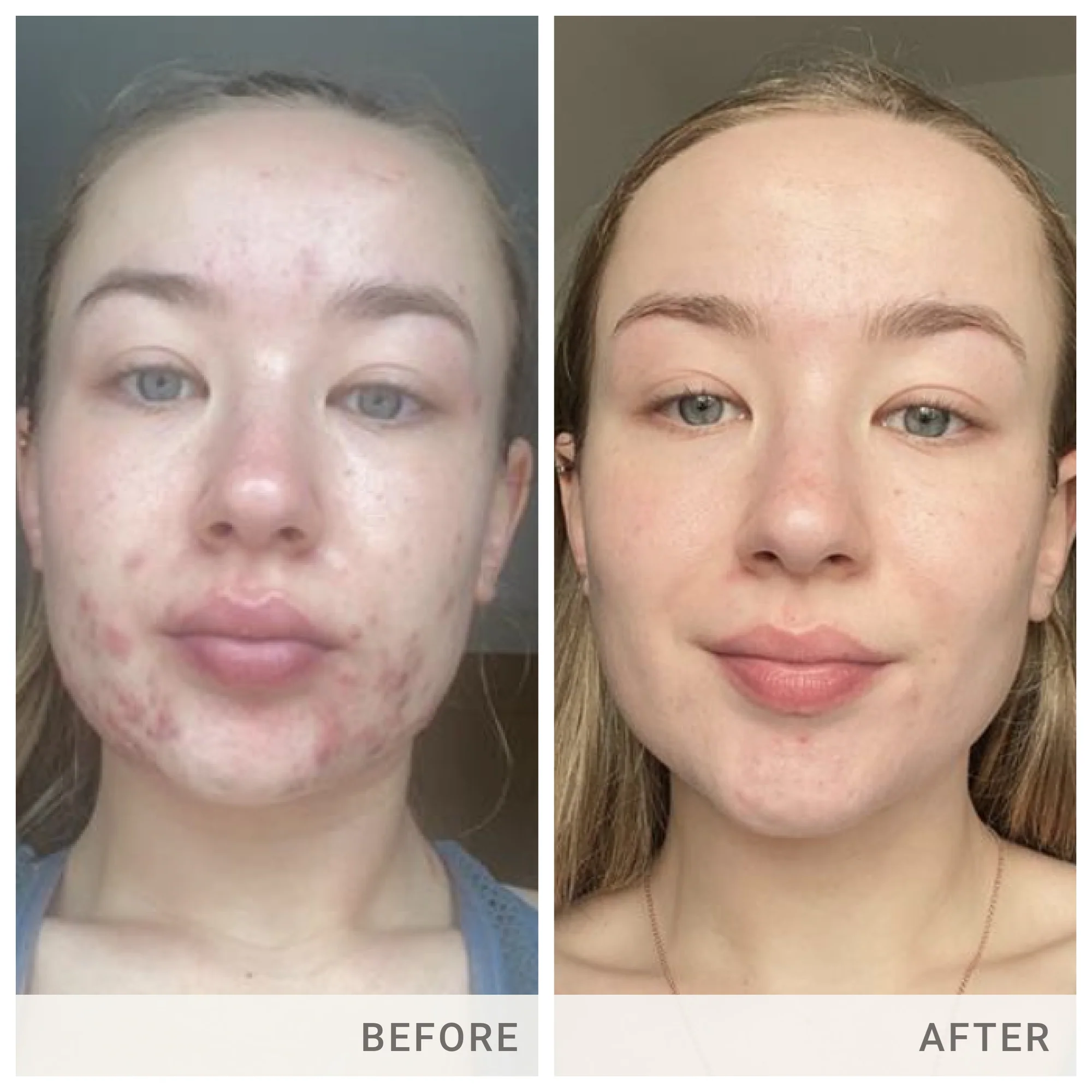 Jane Iredale Skin Accumax - Clear Skin Supplement for Acne & Blemishes | Vegan, Cruelty-Free Skincare | Perfect for Daily Use & Travel