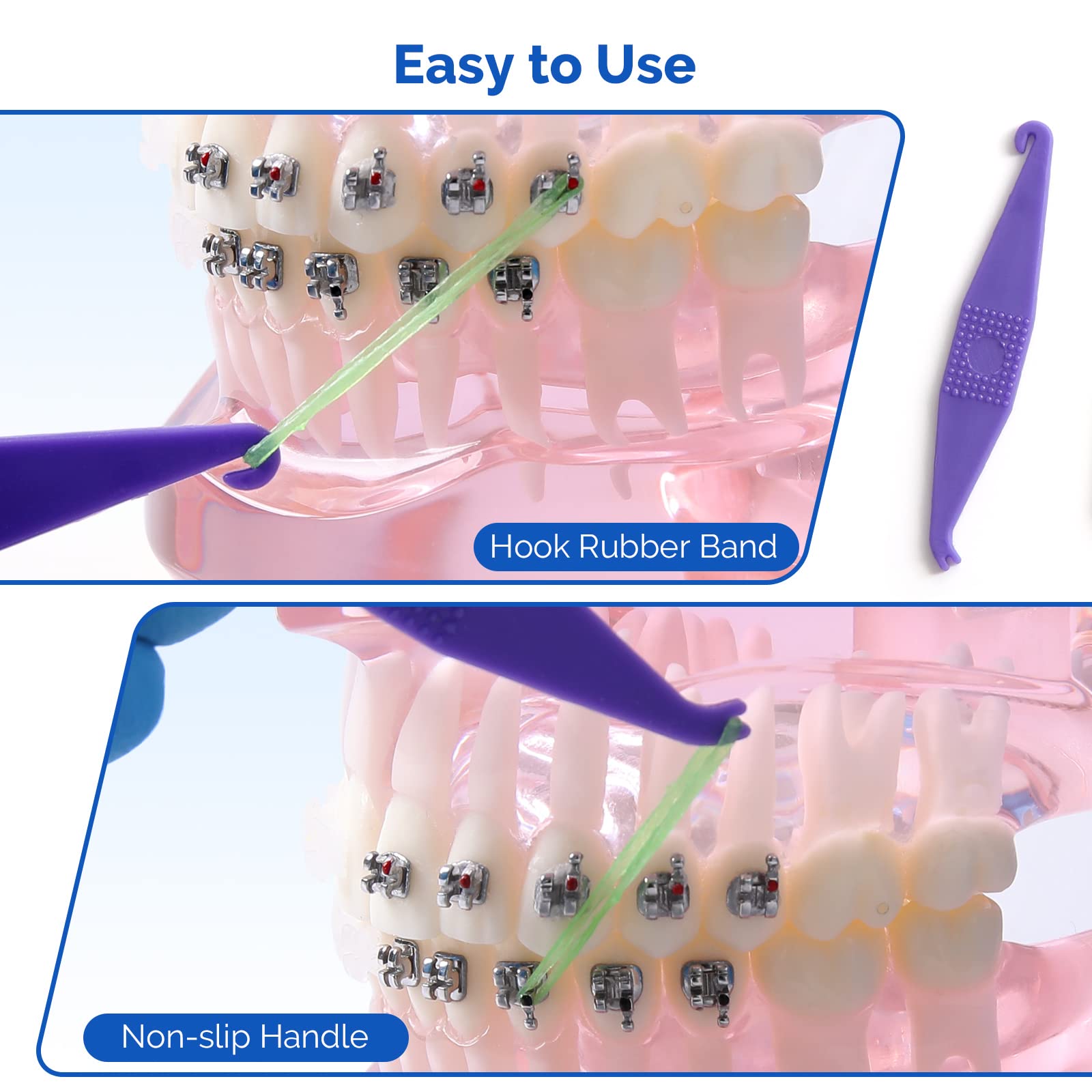 JMU Orthodontic Elastics 5/16 Medium - 500 Pack Latex-Free Neon Intraoral Rubber Bands for Braces | Made in USA | Perfect for Teeth Alignment & Orthodontic Treatment