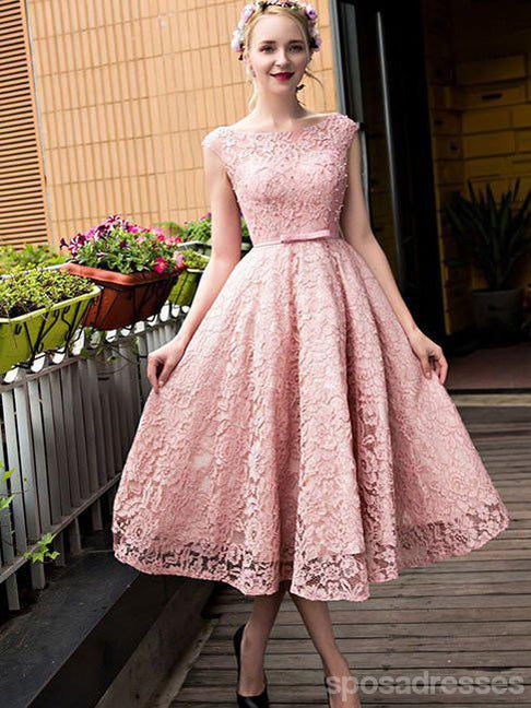 Affordable Pink Lace Cap Sleeve Short Homecoming Dress for Teens - Elegant Prom Party Dress CM681 | Perfect for School Dances, Formal Events & Special Occasions