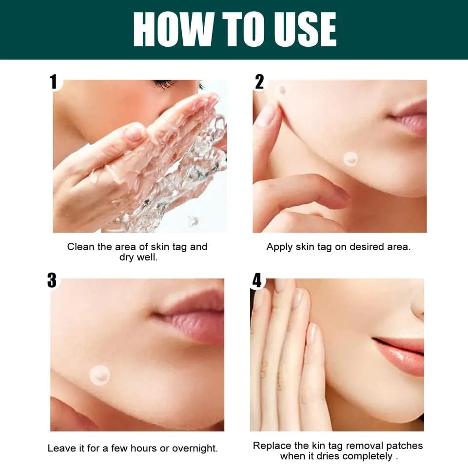 SEFLICA Hydrocolloid Acne Patches for Face - 4 Sizes (72/144 Count) Invisible Pimple Patches with Tea Tree & Calendula Oil - Absorbing Zit Cover for Overnight Spot Treatment | Perfect for Teen Skin Care & Travel Emergency Kit