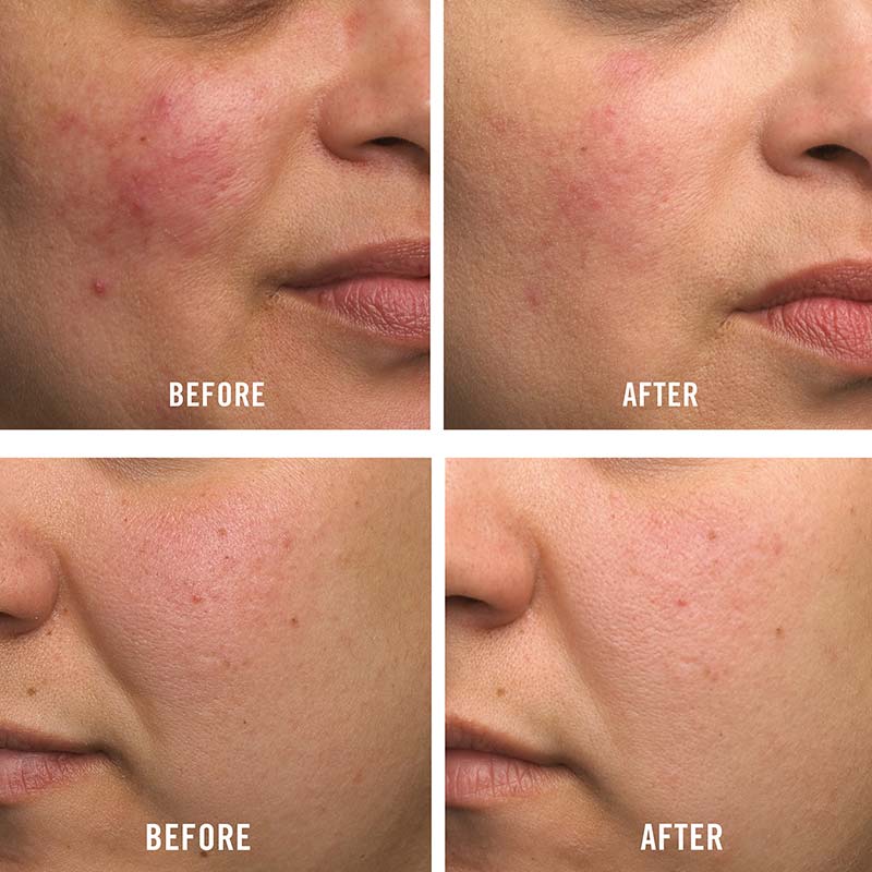 First Aid Beauty Ultra Repair Cream Travel Size - Intense Hydration for Dry Skin - Perfect for Travel & On-the-Go Skincare