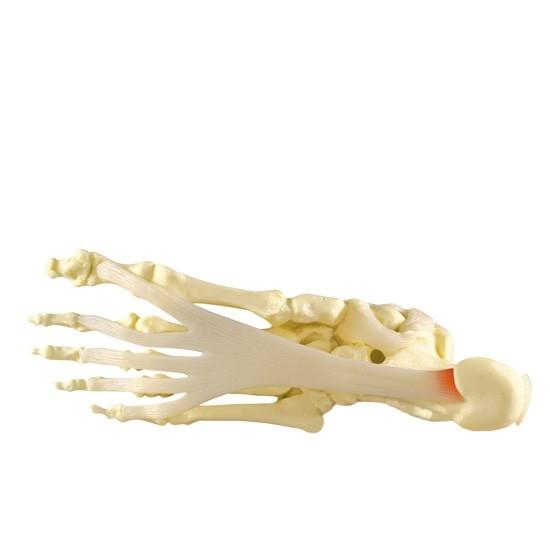 Foot and Ankle Model for Plantar Fasciitis Relief - Ideal for Medical Training, Physical Therapy, and Patient Education