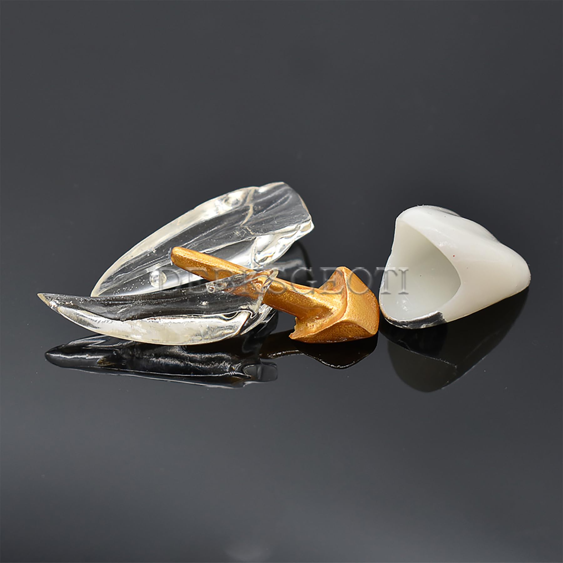 Dental Typodont Model for Caries Treatment - M4008 Anatomical Demonstration Kit for Incisor & Diseased Teeth | Dental Education, Student Practice & Clinical Training
