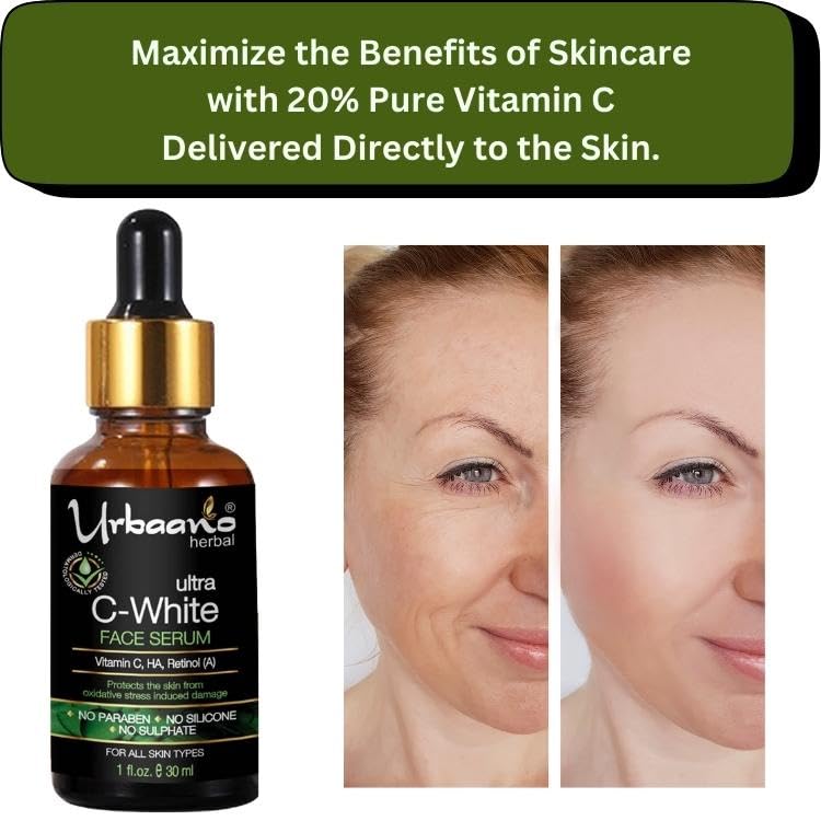 Urbaano Herbal Ultra White Vitamin C Serum - Brightening, Pigmentation & Dark Spot Corrector, Hydrating Facial Serum 30ml for Glowing Skin - Perfect for Daily Skincare & Anti-Aging Routine