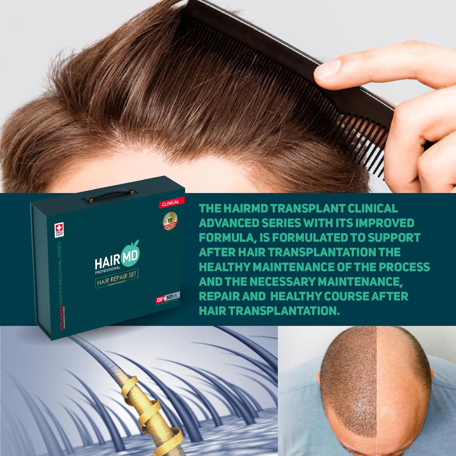 Post-Transplant Hair Care Set - 3-Month Treatment Kit with Biotin Shampoo, Hair Growth Serum, Multivitamin & Meso Formula | Keratin & Collagen Enriched for Faster Recovery | Ideal for Post-Surgery Scalp Care & Hair Regrowth