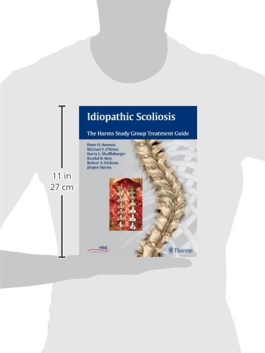 Idiopathic Scoliosis Treatment Guide - Harms Study Group Recommendations for Spinal Correction & Pain Relief | For Doctors, Physical Therapists & Patients