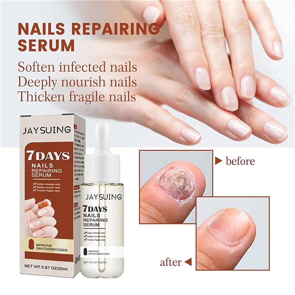 Pisheng 7-Day Nail Growth & Strengthening Serum - 20ml (2-Pack) | Fast Nail Treatment for Stronger, Healthier Nails | Perfect for Brittle Nails & Nail Care Routine