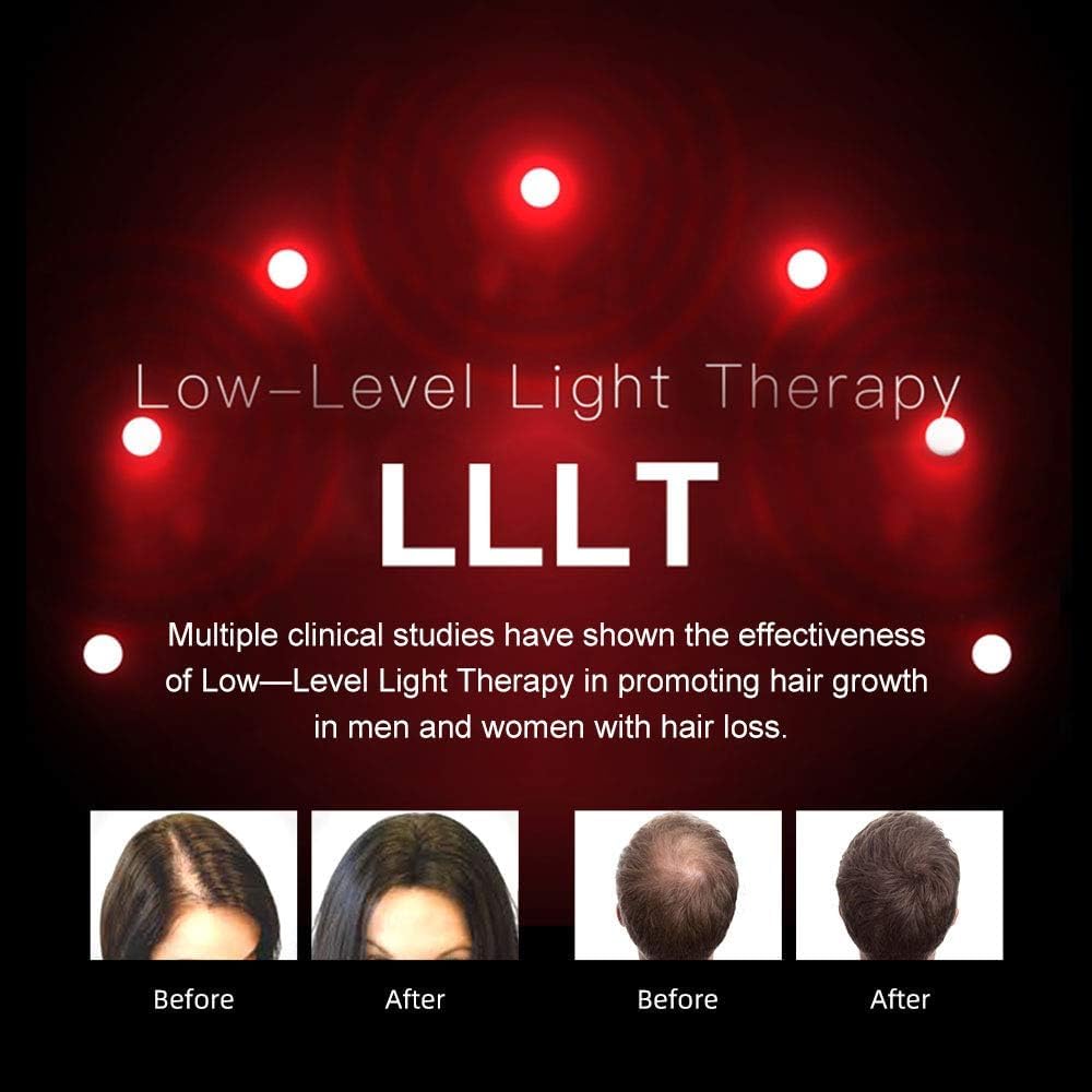 DROZIP Laser Hair Growth Device for Thinning Hair - Hair Hydration & Hair Loss Treatment for Men & Women - Stimulate Hair Regrowth at Home | Perfect for Daily Scalp Care & Thicker Hair Maintenance