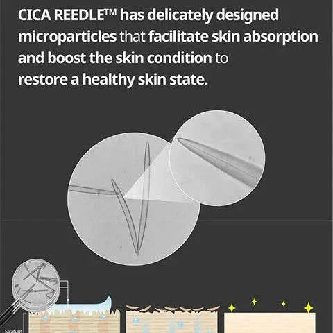 VT Reedle Shot 300 Stick Pouch - 2mL x 10 Pack | Disposable Micro Needle Patches for Skin Rejuvenation & Wrinkle Reduction | Perfect for At-Home Skincare & Beauty Treatments