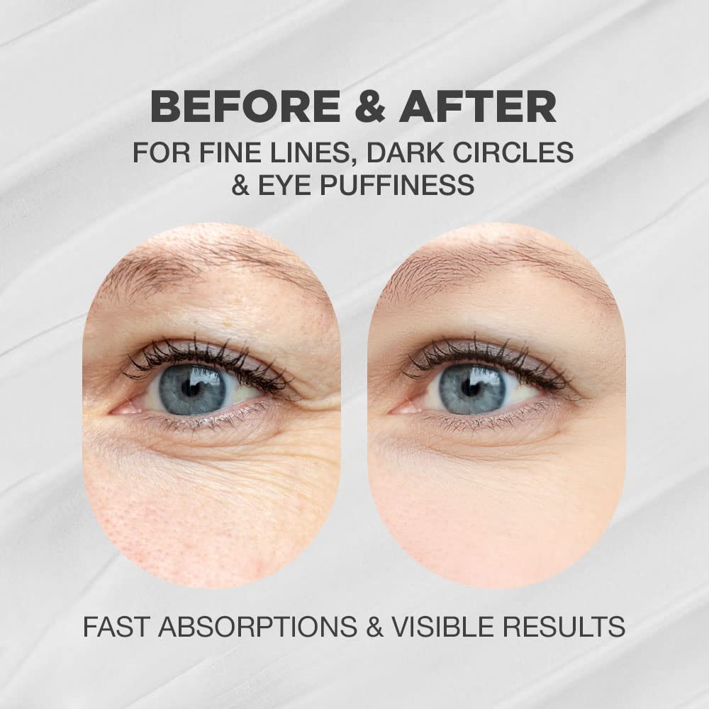 **Korean Ginseng Eye Cream with 54% Ginseng Extract – Dark Circle & Puffiness Treatment for Sensitive Skin | Anti-Aging, Hydrating & Rejuvenating Eye Cream with Centella Asiatica & Rosemary | Best for Morning & Night Skincare Routine – 1.01 fl oz**