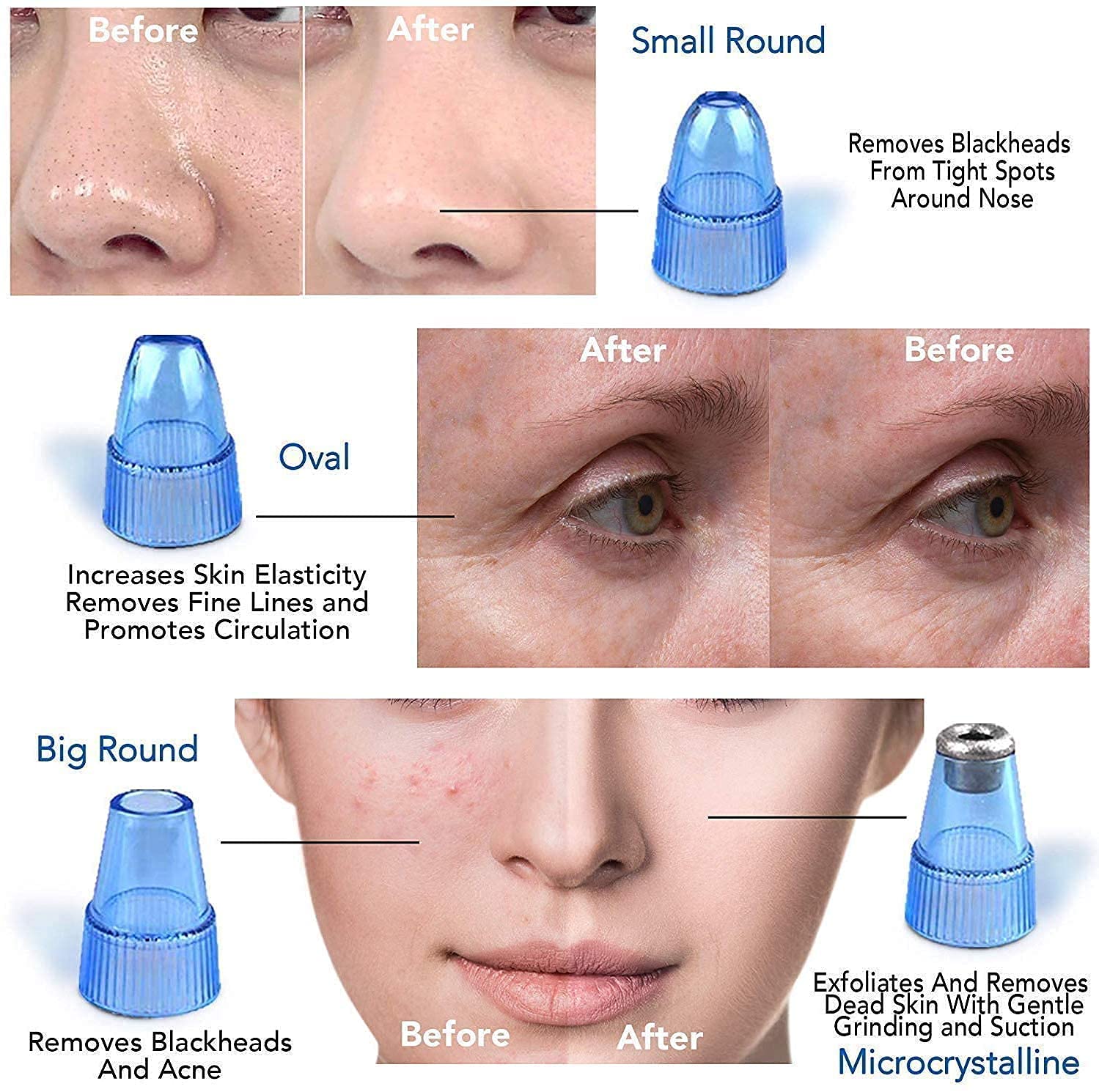 Professional Multi-Functional Vacuum Acne Pore Cleaner & Blackhead Remover Kit - Facial Skin Care Tool for Men & Women | Pimple & Acne Extraction, Deep Cleansing | Perfect for Daily Skincare Routine & Spa Treatments