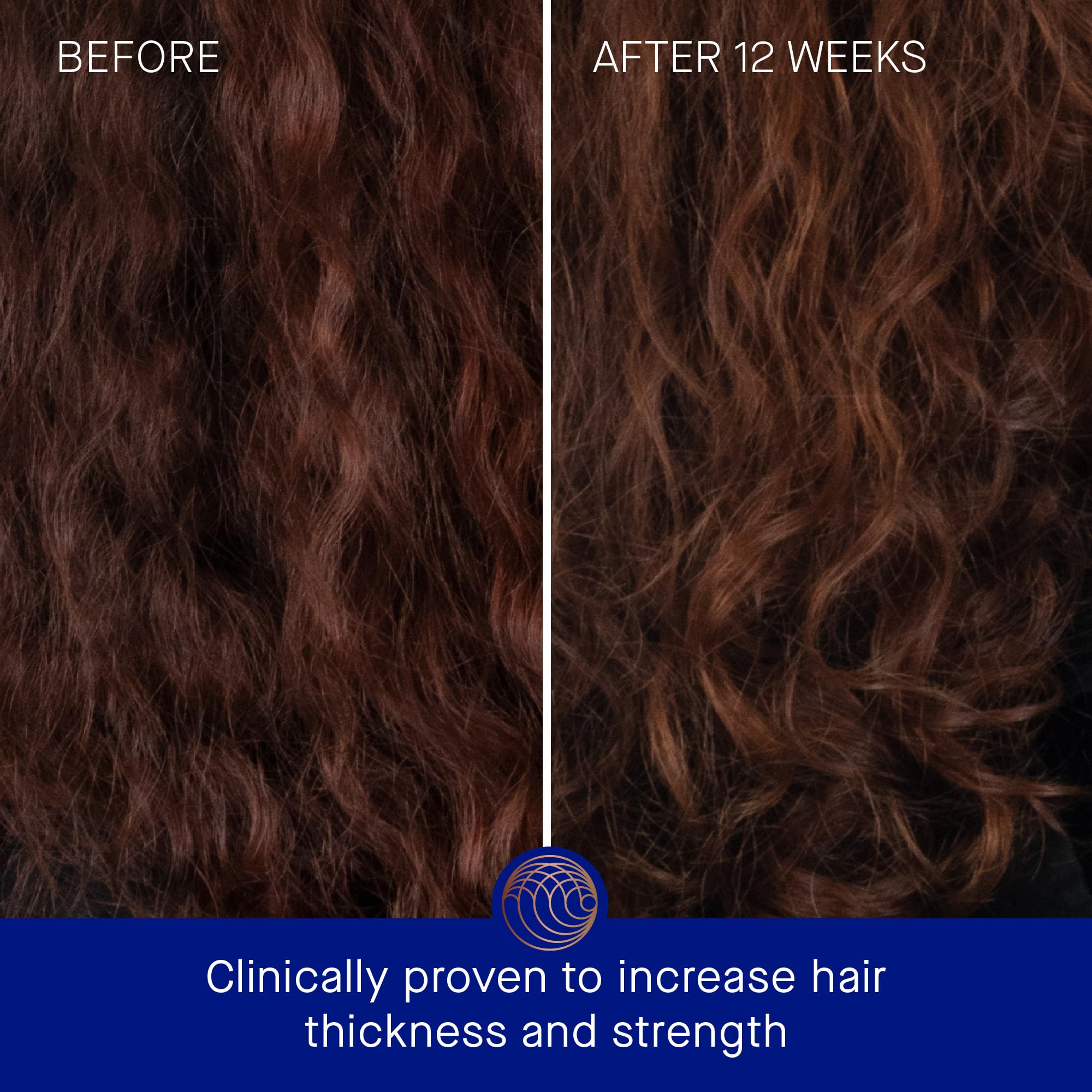 Augustinus Bader The Shampoo - Hydrating & Repairing Hair Care for Damaged Hair - Perfect for Daily Use & Color-Treated Hair