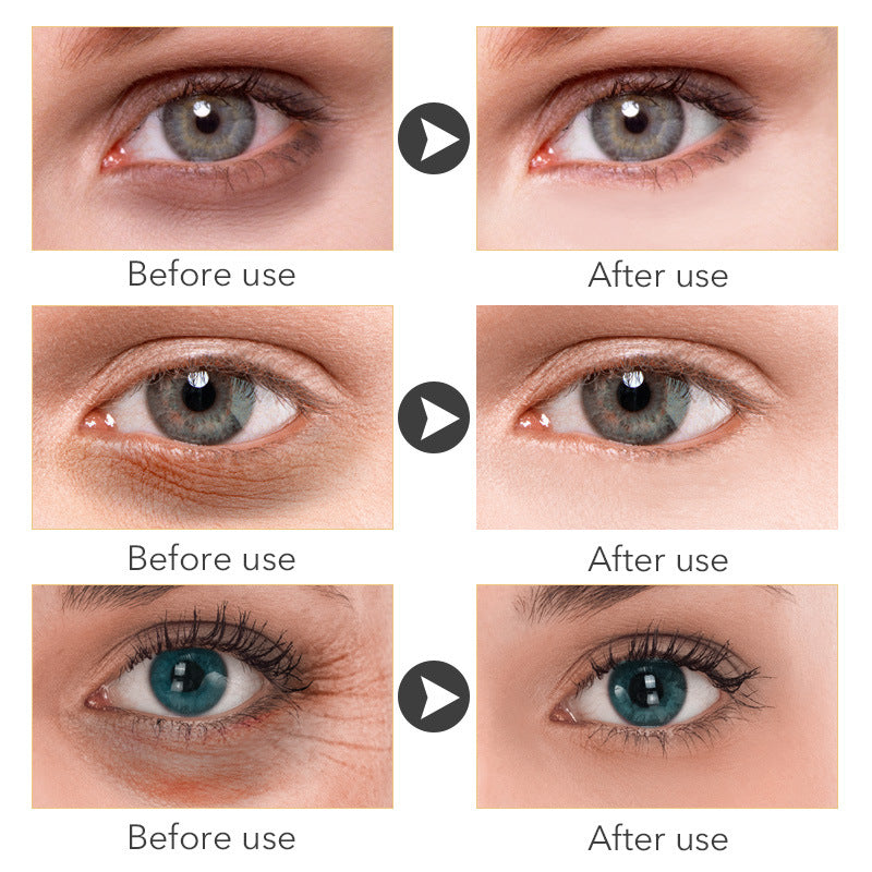 30ml Anti-Aging Eye Cream for Women - Dark Circle & Wrinkle Treatment - Hydrating Under Eye Cream for Night & Day Use - Perfect for Daily Skincare Routine