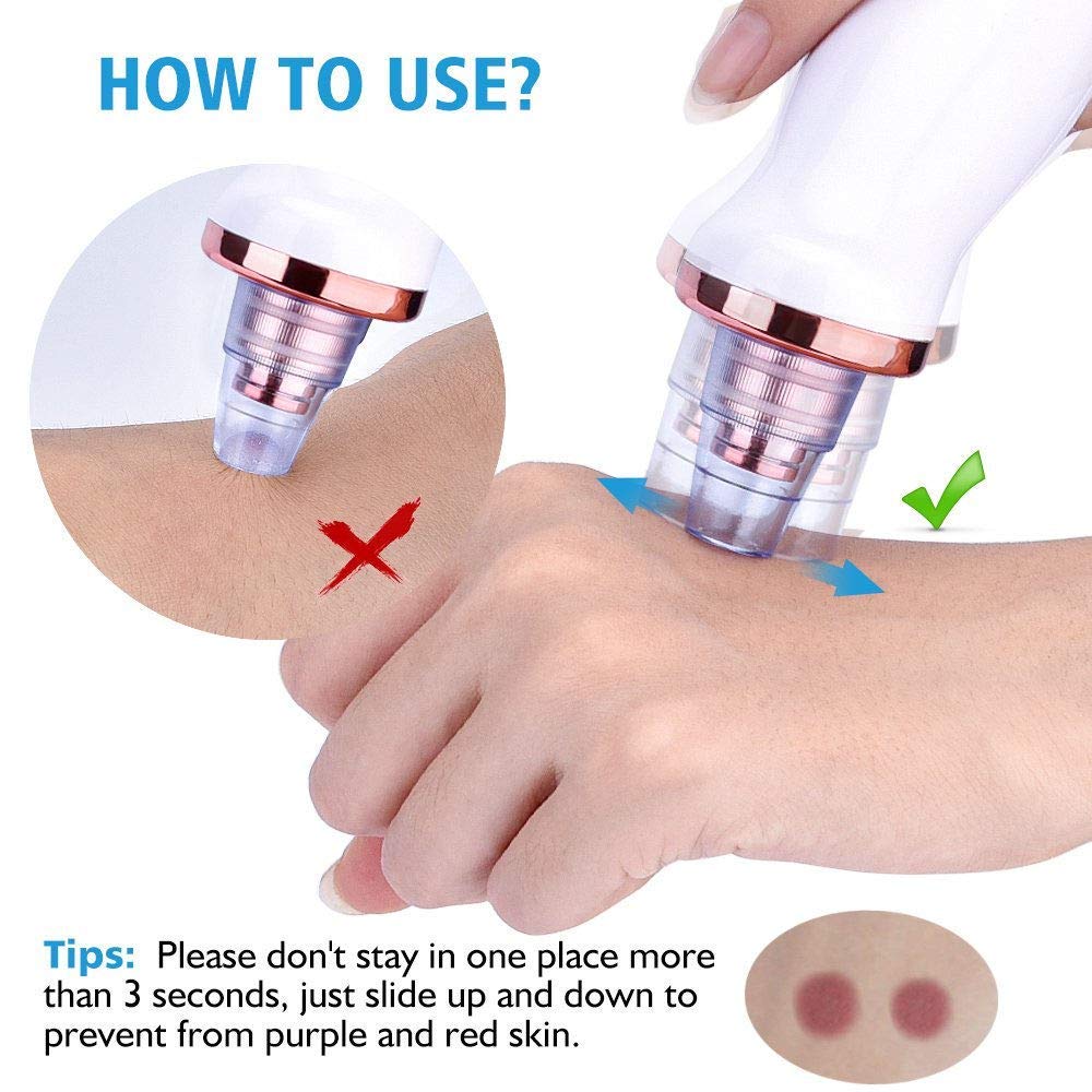 Premium 6-in-1 Blackhead Remover Vacuum - Rechargeable Pore Cleaner with 3 Adjustable Modes & 6 Attachments for Blackheads, Whiteheads & Acne | Professional Skin Care Device for Men & Women | Perfect for Daily Facial Cleansing & Spa Treatments