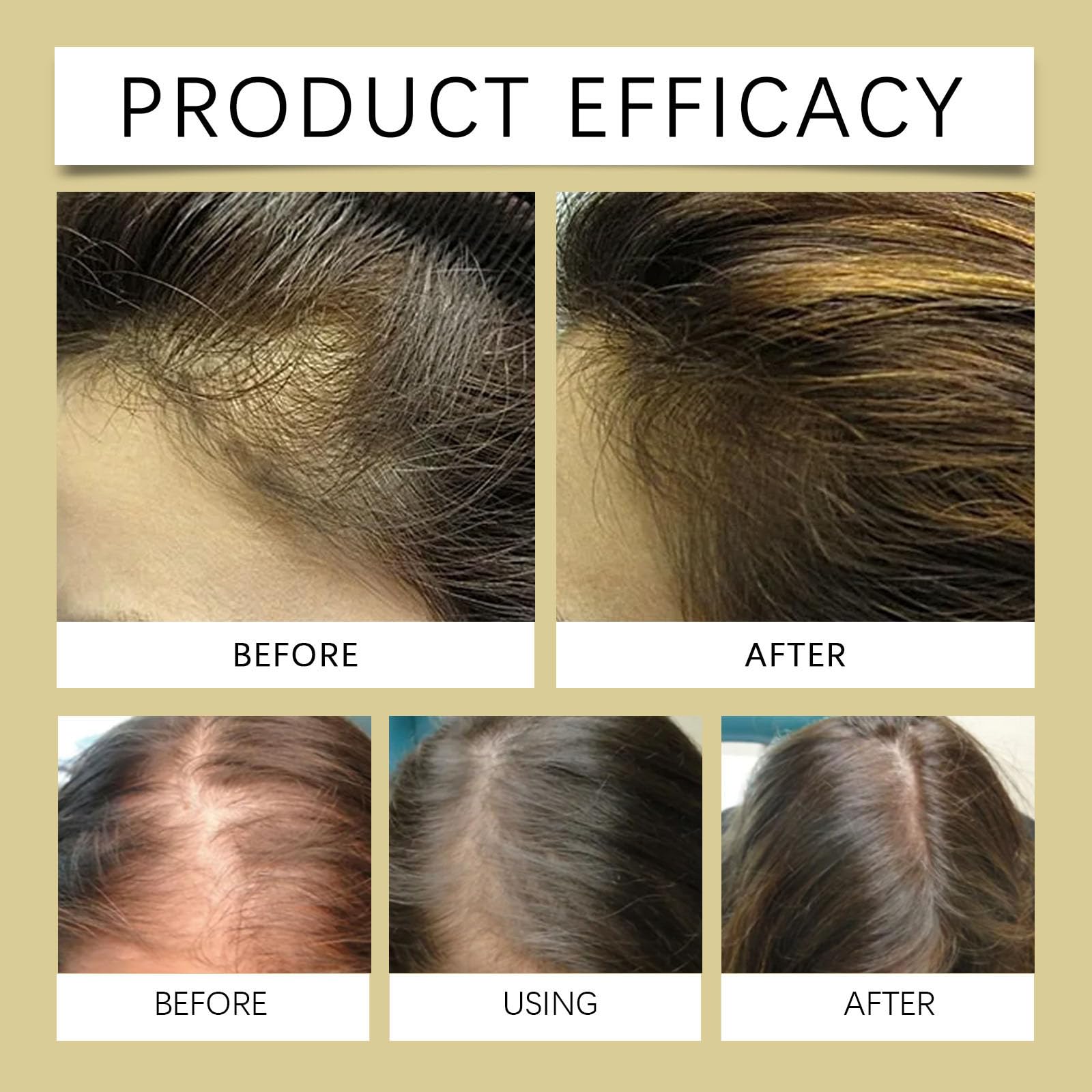 Natural Rosemary Essential Oil for Hair Growth - Organic Hair Growth Treatment with Shampoo - Promotes Thicker, Healthier Hair for Men & Women - Perfect for Daily Scalp Massage & Hair Care Routine
