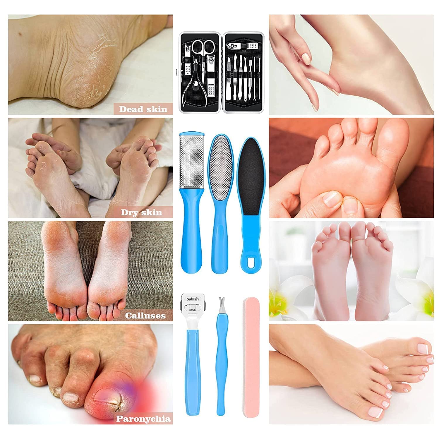 HUDACRUSH 8-in-1 Professional Pedicure Kit for Soft Feet - Callus Remover, Foot Scrubber, Nail File & More - Perfect for Home Spa, Pedicure & Foot Care Routine