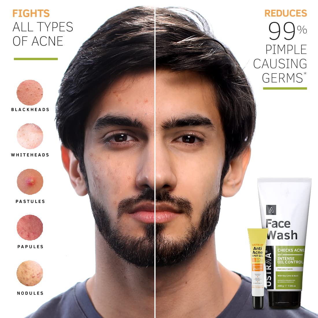 Ustraa Anti-Acne Kit with 2% Salicylic Acid & Neem - Includes Spot Gel (15ml) & Face Wash (200g) - Reduces 99.9% Pimple-Causing Germs - Specially Formulated for Oily Skin - Perfect for Daily Acne Treatment & Clear Skin Care Routine
