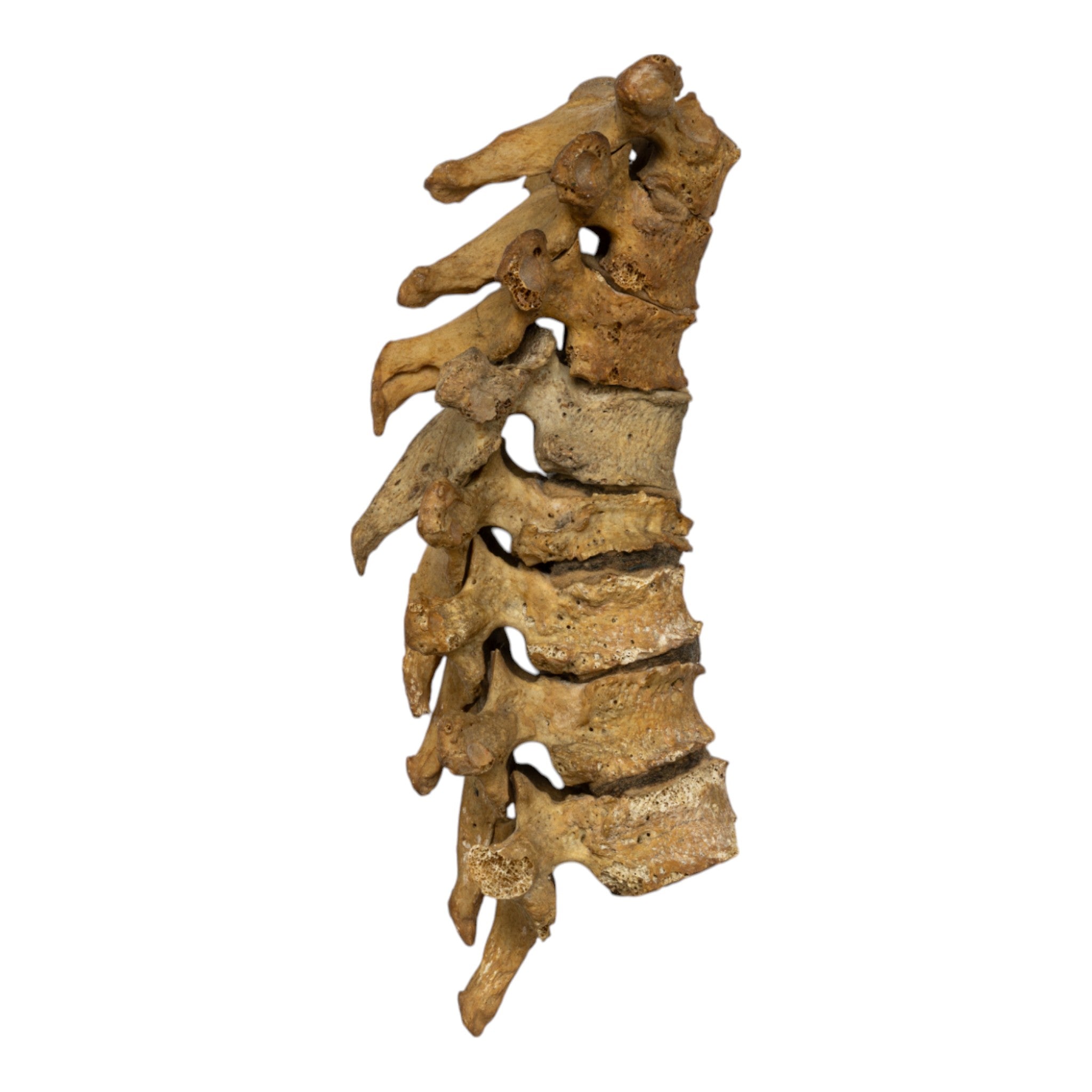 Authentic Human Thoracic Vertebrae Set of 8 - Perfect for Medical Education, Anatomy Study & Skeletal Display