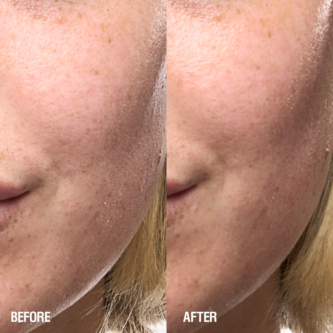 Grown Alchemist Skin Renewal Serum - Anti-Aging Face Serum with Hyaluronic Acid & Vitamin C for Hydration & Brightening - Perfect for Nighttime Skincare Routine & Daily Use