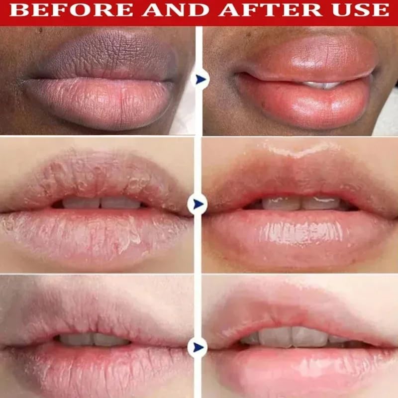 2PCS Sunscreen Lip Balm - Fast Dark Lip Lightener for Dry, Sunburned Lips - Makeup & Daily Care