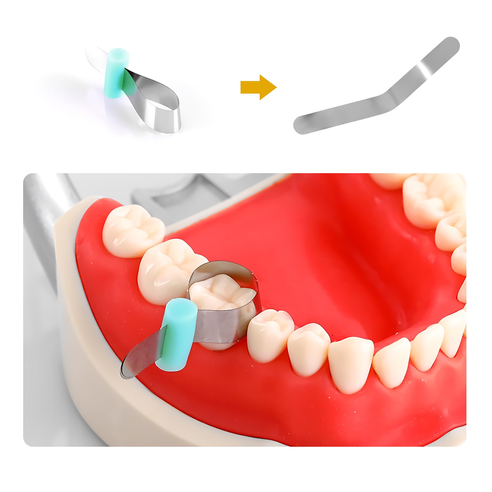 50Pcs Dental Matrix Bands for Metal Restoration - Retainerless Orthodontic Sectional Contoured Matrices Automatrix with Lock - Perfect for Dental Clinics & Orthodontic Procedures