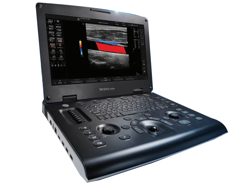 GE Versana Active Portable Ultrasound Machine - High-Resolution Imaging for Point-of-Care Diagnostics | Perfect for Clinics, Emergency Rooms & Mobile Medical Services
