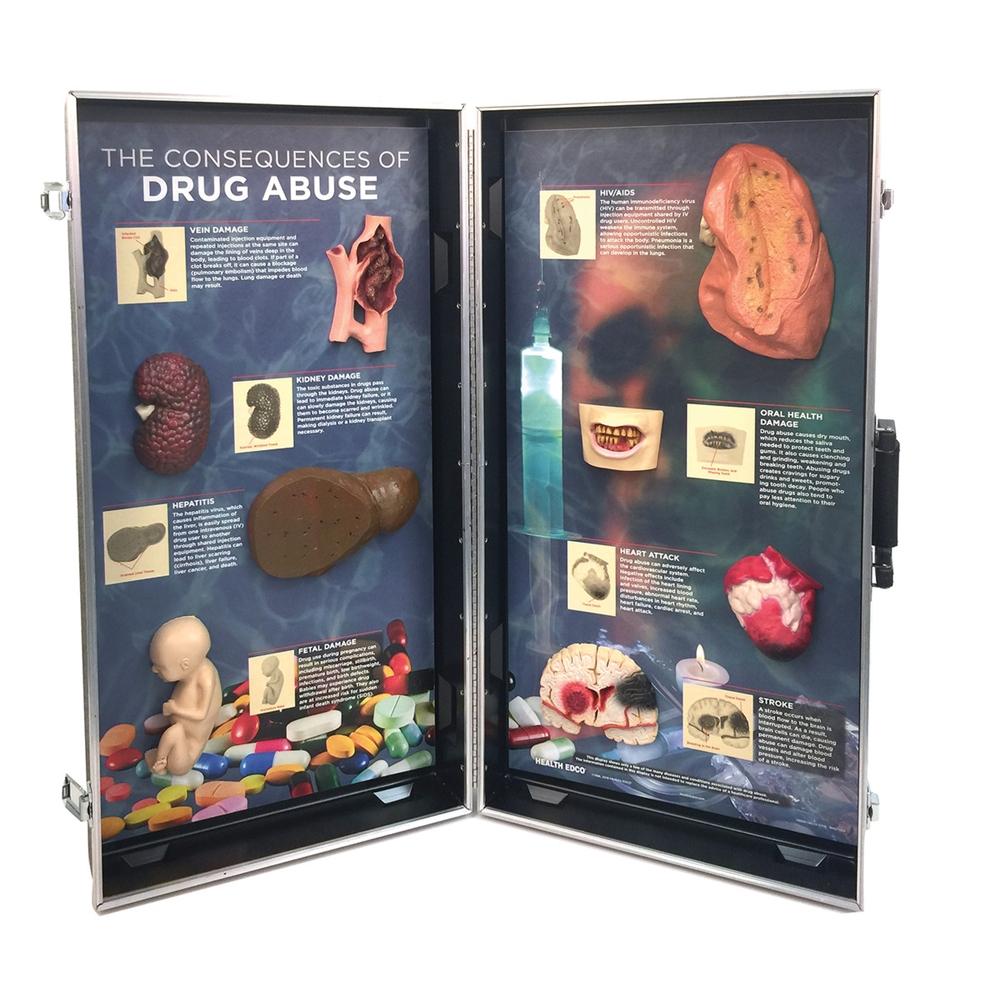 3D Educational Display on Drug Abuse Consequences - Visual Learning Tool for Schools & Awareness Programs