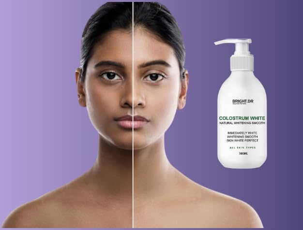 SnowFlower Skin Brightening & Lightening Lotion for Face & Body - Even Skin Tone, Reduce Dark Spots - Perfect for Daily Skincare Routine & Hyperpigmentation Treatment
