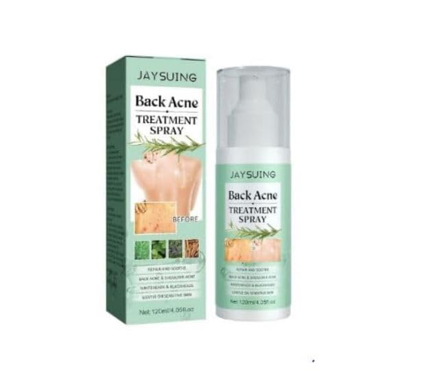 Ramley Fast-Acting Acne Treatment Spray - 120ml Clear Skin Solution for Face & Body | Reduces Blemishes & Breakouts | Perfect for Daily Skincare Routine & On-The-Go Use