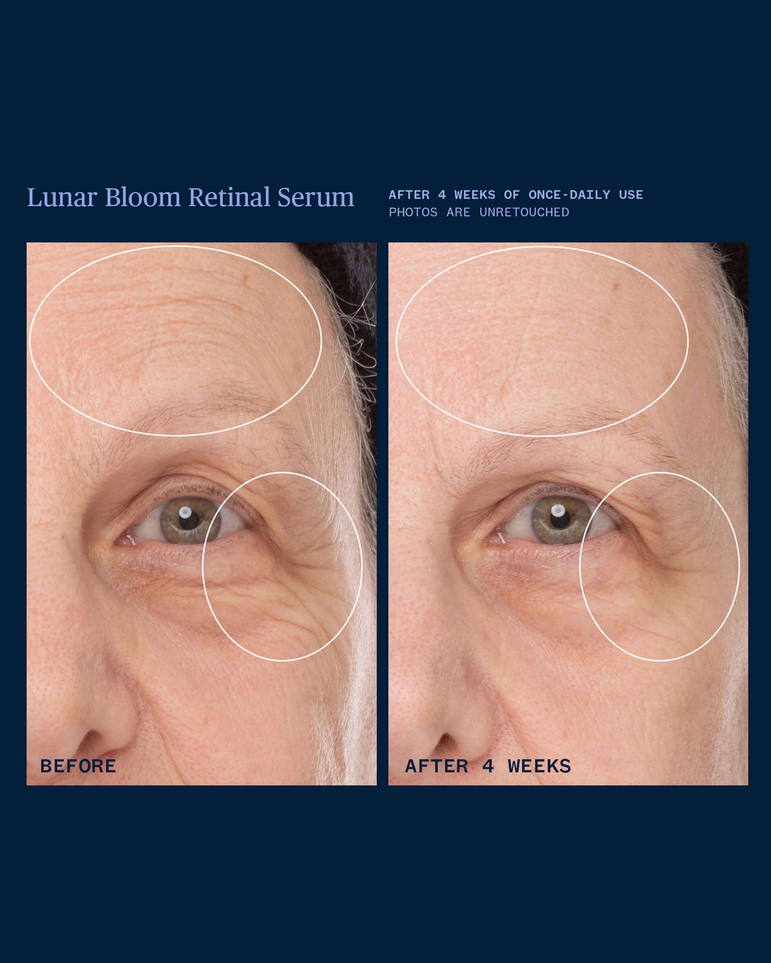 Lunar Bloom Retinal Serum - Anti-Aging Face Serum with Retinol for Wrinkles & Fine Lines | Night Repair Treatment for Glowing Skin