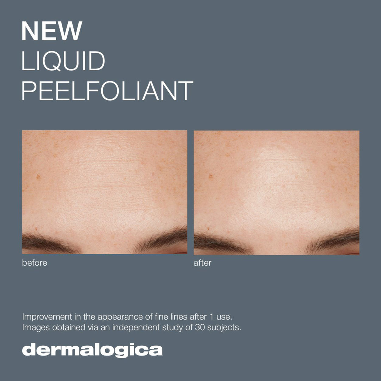 Best Liquid Peelfoliant for Glowing Skin | Exfoliating Face Peel for Smooth & Bright Complexion | Perfect for Daily Skincare Routine & Spa Treatments