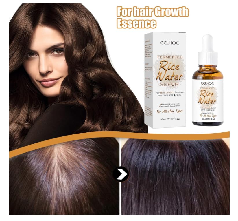 HERBALIX LuxuryHerbs Rice Water Serum for Hair Growth - 30ml Hair Growth Treatment for Thinning Hair & Hair Loss in Women & Men | Strengthens & Nourishes Hair for Daily Use at Home or Salon