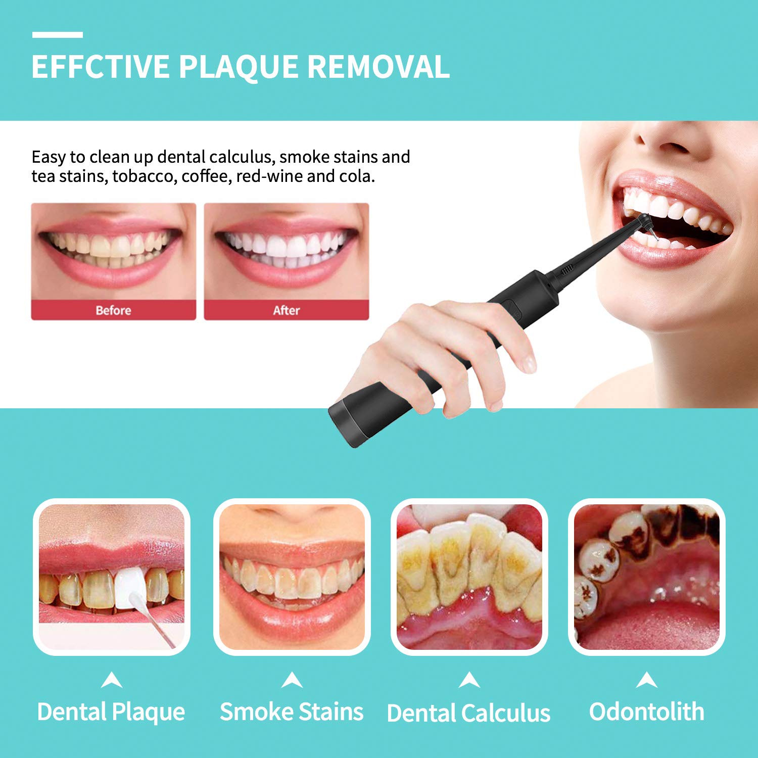 Portable Teeth Cleaner Kit with 3 Modes, LED Light & 2 Replaceable Heads - Electric Plaque Remover for Travel, Home & Dental Care - Whitening & Deep Cleaning Oral Hygiene Tool