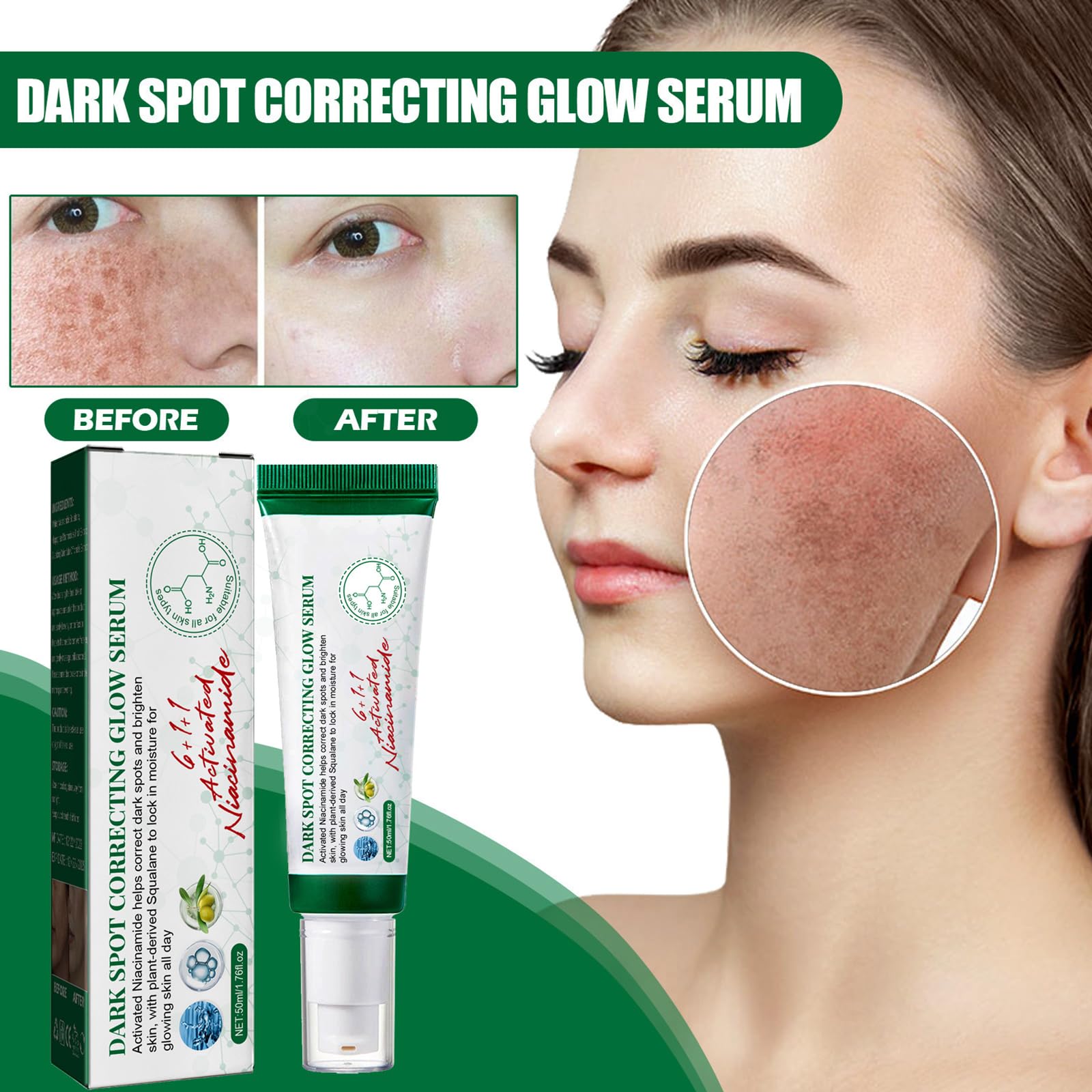 KOAHDE Anti Stain Face Serum & Dark Spot Correcting Cream - Skin Brightening, Lightening & Moisturizing Treatment for Hyperpigmentation & Uneven Tone | Day & Night Use for Glowing Complexion