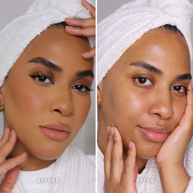 Alpha H Melting Moment Cleansing Balm - Gentle Makeup Remover & Deep Cleanser for All Skin Types | Perfect for Daily Skincare & Travel Essentials