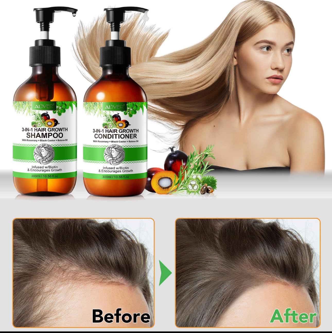 **Jamaican Black Castor Oil + Rosemary Oil + Batana Oil Hair Growth Set - Shampoo & Conditioner for Thicker, Healthier Hair - Natural & Organic Hair Care for Women & Men - Perfect for Dry, Damaged Hair & Scalp Care**    *(Use Case: Promotes hair growth, reduces breakage, and deeply nourishes dry or damaged hair. Ideal for daily use to strengthen and revitalize hair follicles.)*
