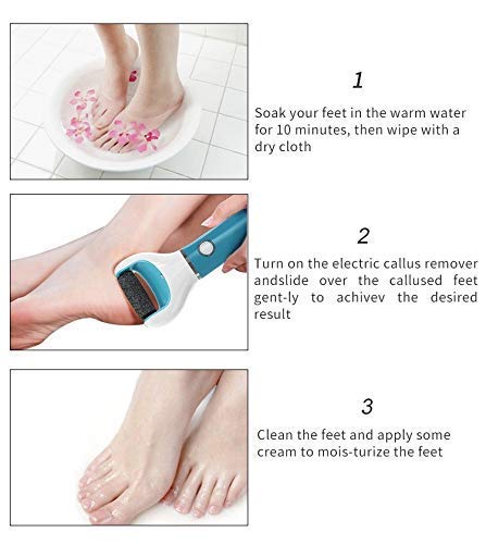 Diazola Professional Callus Remover & Foot File - Pedicure Tool for Dry, Dead, Hard & Cracked Skin - Foot Care Treatment for Soft Smooth Feet - Perfect for Home Pedicures & Salon Foot Care
