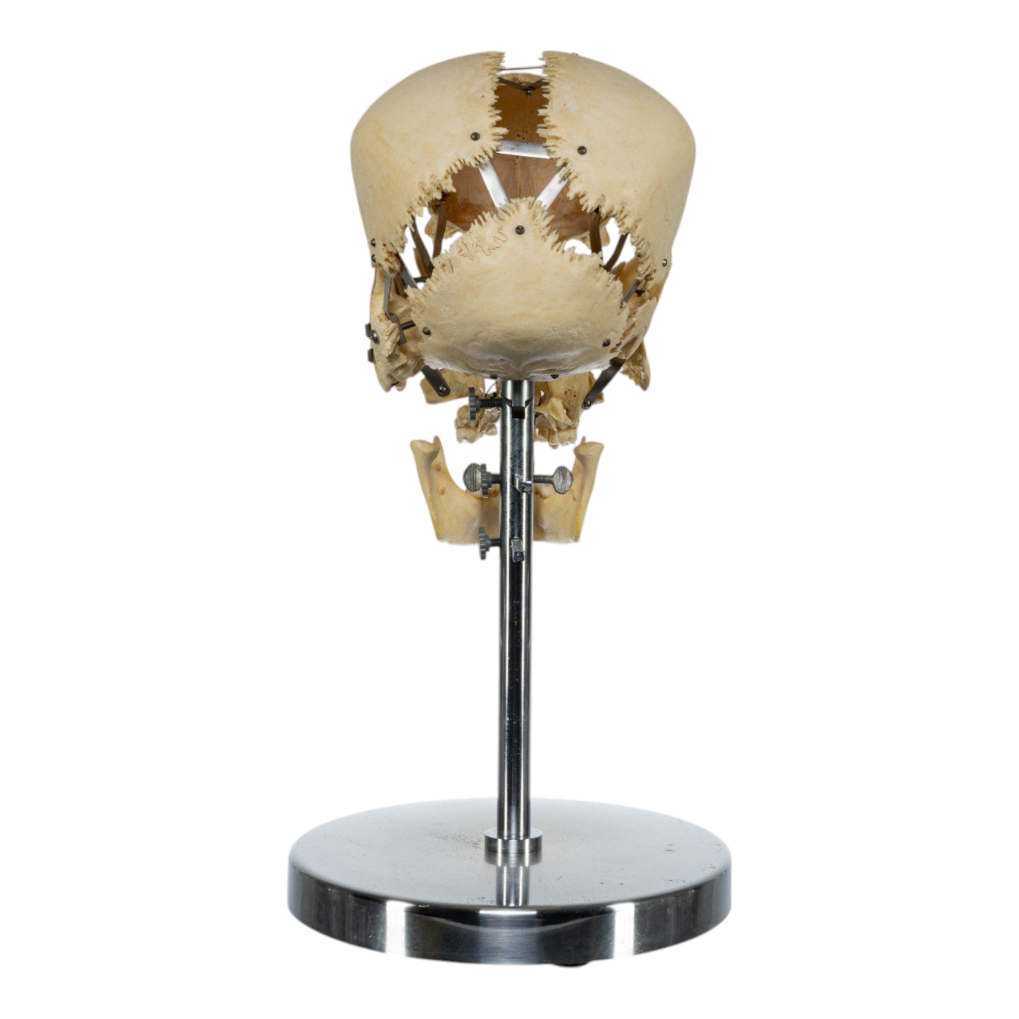 Real Human Exploded Skull Model on Display Stand - Perfect for Anatomy Study, Medical Education & Halloween Decor
