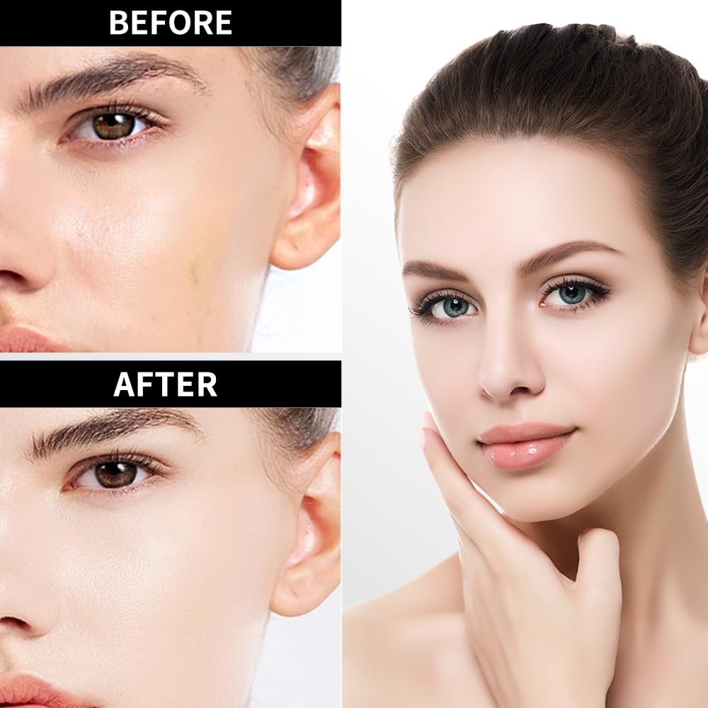 VGO Skincare Vitamin C Body Oil Serum - Brightening & Hydrating Treatment for Glowing Skin | Perfect for Dry Skin, Stretch Marks & Evening Skincare Routine