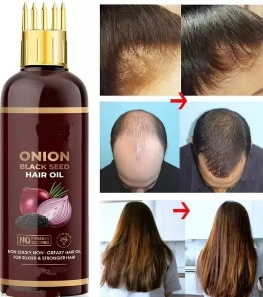 MFHL Onion Black Seed Hair Oil for Hair Growth & Thickness - Comb Applicator Included - Promotes Healthy Scalp & Stronger Hair - Perfect for Daily Hair Care & Styling