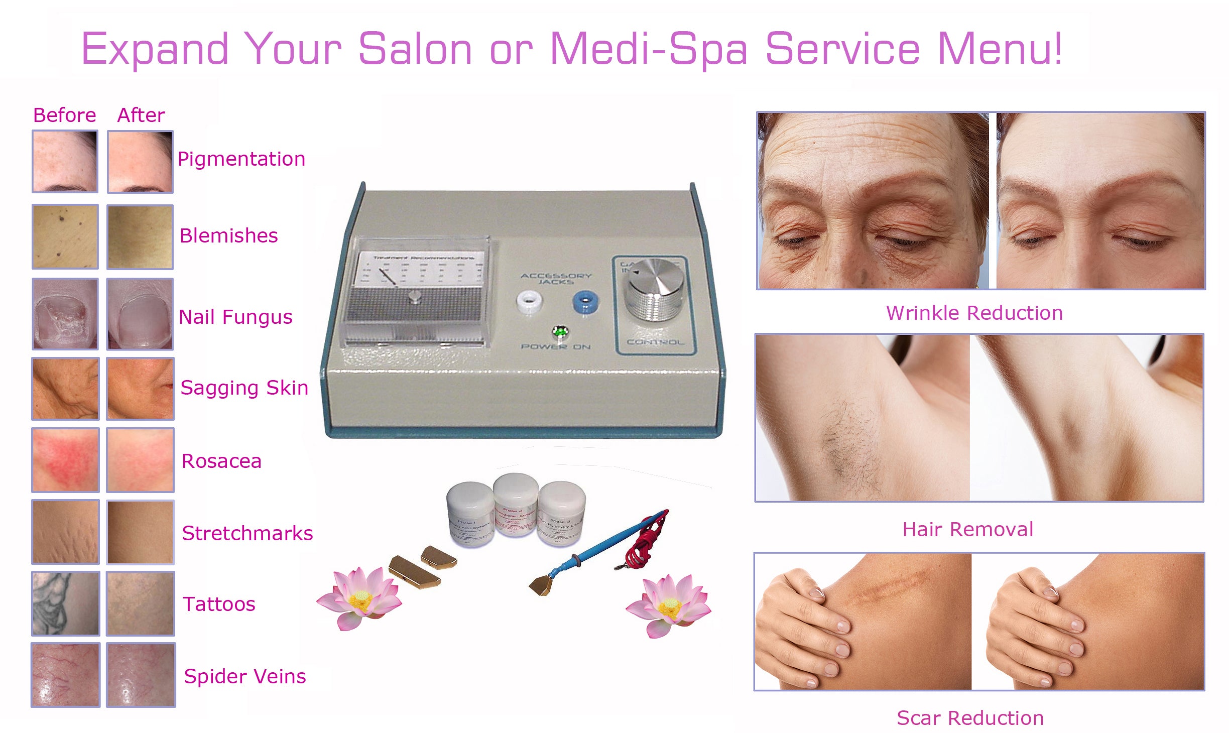 Professional Tattoo Removal System - Non-Laser Treatment Machine with Microlysis Gel Kit for Safe & Effective At-Home Tattoo Fading (Ideal for Small Tattoos, Cover-Ups & Touch-Ups)