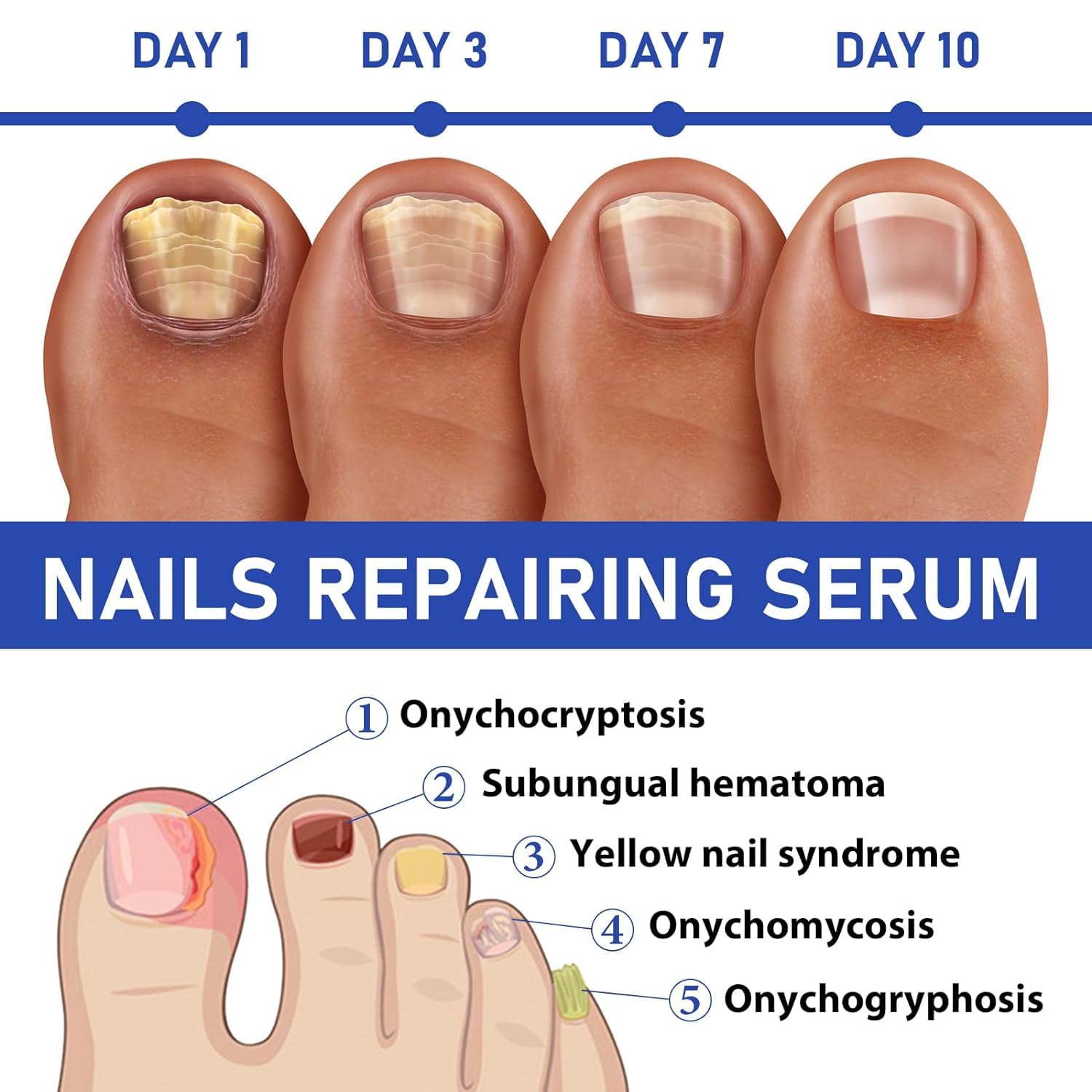 OnyxoGuard Nail Growth & Repair Serum - Nail Strengthener for Thin, Brittle & Damaged Nails - Polish Repair Essence & Base Coat Treatment - Perfect for Salon & Home Nail Care