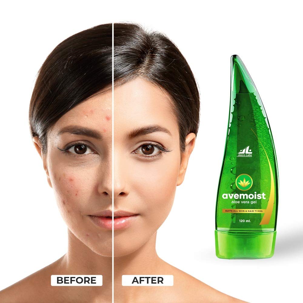 Ave Moist Gel - Hydrating Skin Moisturizer for Dry & Sensitive Skin | Daily Face & Body Lotion | Perfect for Post-Workout, Travel & Winter Care
