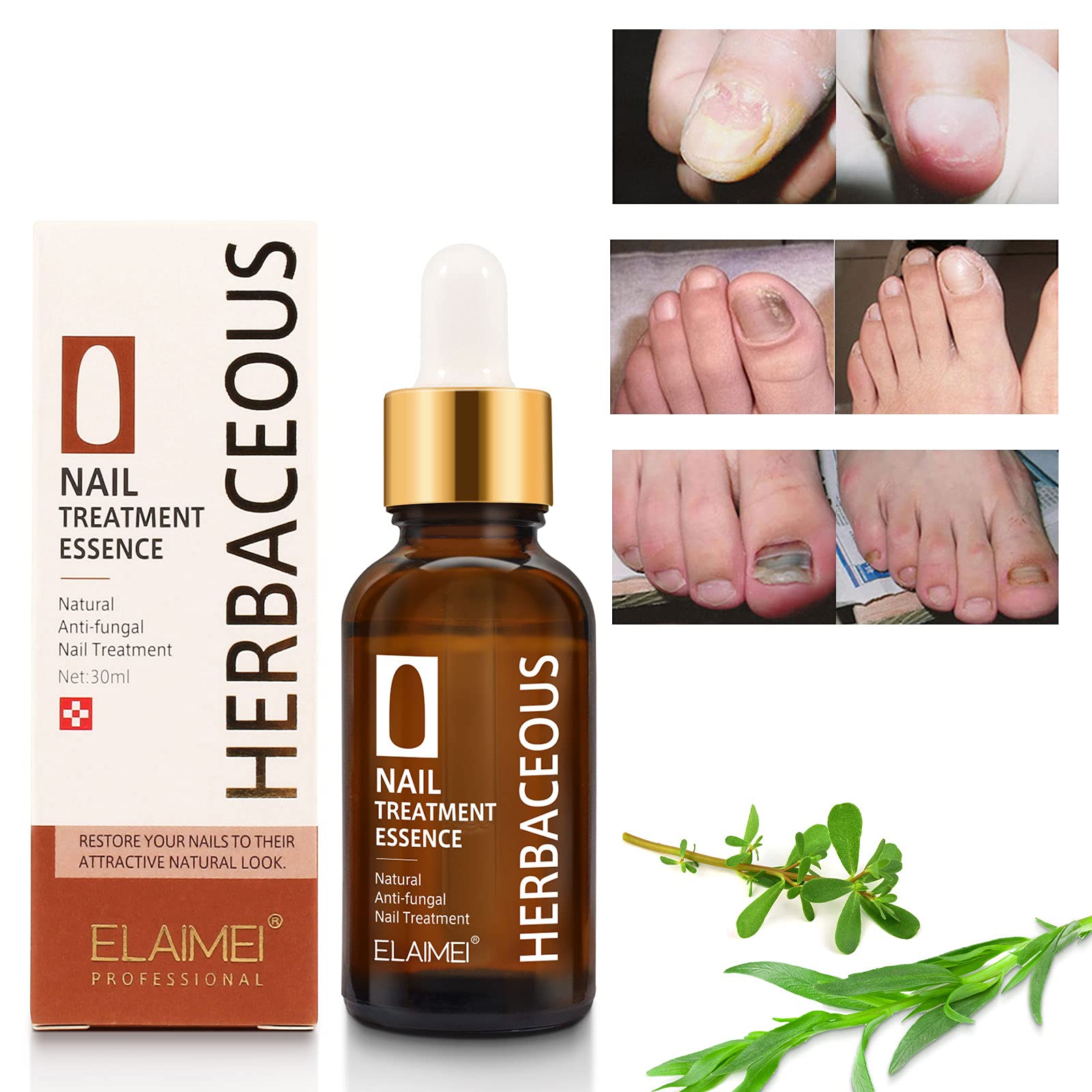 Extra Strong Fungal Nail Treatment for Toenails - Anti-Fungus Solution to Repair & Protect Discolored, Brittle & Cracked Nails - Restores & Rehydrates Damaged Nails (30ML) - Ideal for Athletes, Swimmers & Daily Foot Care