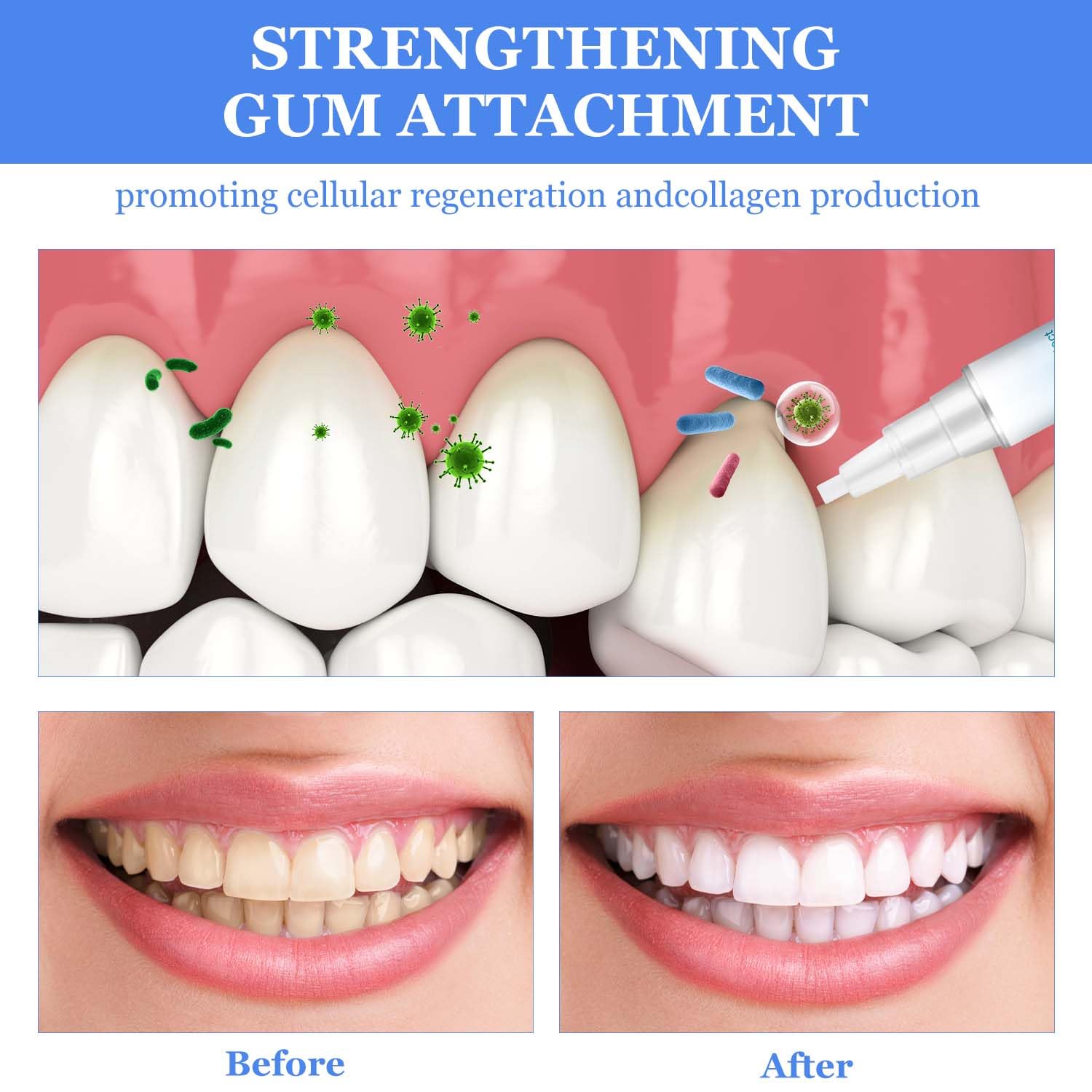 BSOON Gum Therapy Gel - 3 Pack Teeth Whitening Sticks for Sensitive Gums, Stain Remover & Whitening Essence for Brighter Smile | Perfect for Daily Oral Care & Travel Use